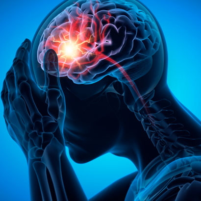 illustration-of-brain-injury
